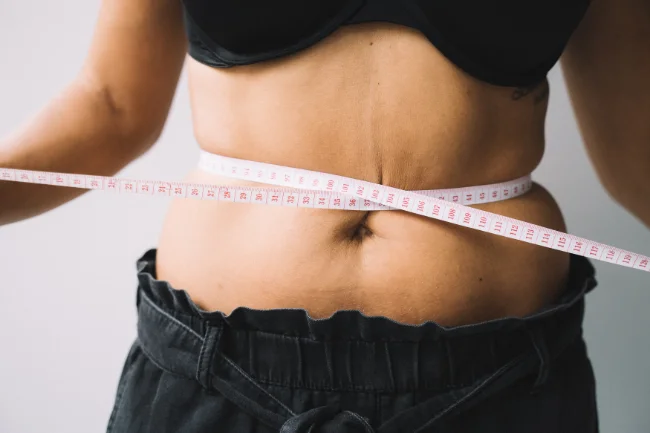 El candidato ideal para una Abdominoplastia