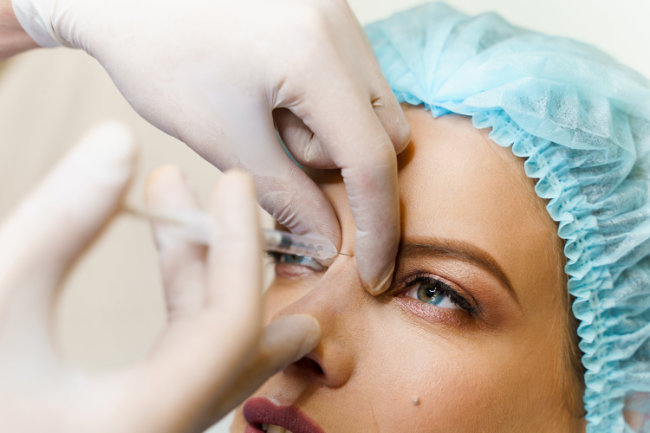 Dermal Filler Injection on the Glabella
