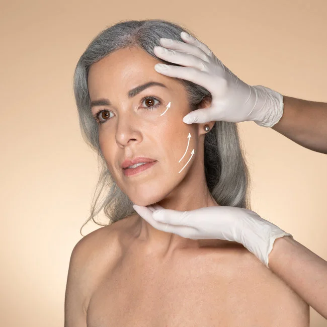 Different Phases Approach of Dr. Cocco for Facelift Surgery