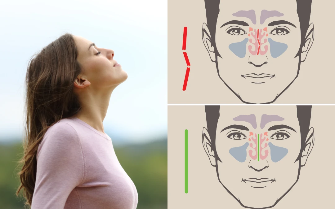 Different Types of Nose Surgery to Breathe Better - Featured