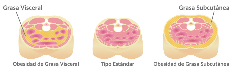 Grasa Visceral - BMI Ideal Para Cirugía Plástica - Featured Image