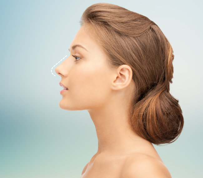 Rinoplastia en Dallas, TX - Cirugia de Nariz