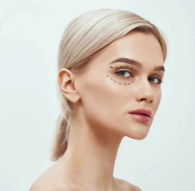 Transferencia de Grasa Facial alrededor de los ojos