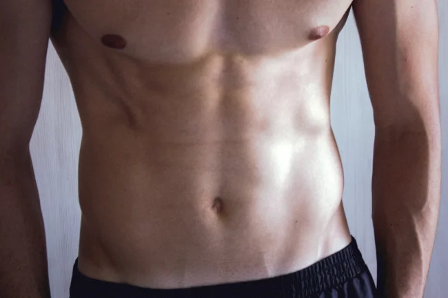 Tummy Tuck for Men in Dallas, TX - Abdominoplasty for Men living in Dallas, TX